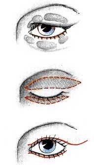 Cosmetic Surgery In Prague