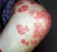 Pain Relief &amp; Acupuncture Centre (Blackpool)