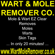 Mole removal Remove moles without surgery in a few minutes.